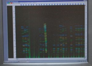 profil DNA na ekranie komputera