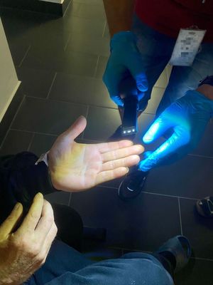 Na zdjęciu widać jak technik policyjny oświetla dłonie zatrzymanemu za rozbój celem sprawdzenia dłoni pod wykonanie daktyloskopii