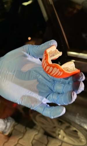 Policjant trzyma szczękę.