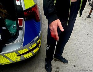 Ranny mężczyzna stoi przy radiowozie.