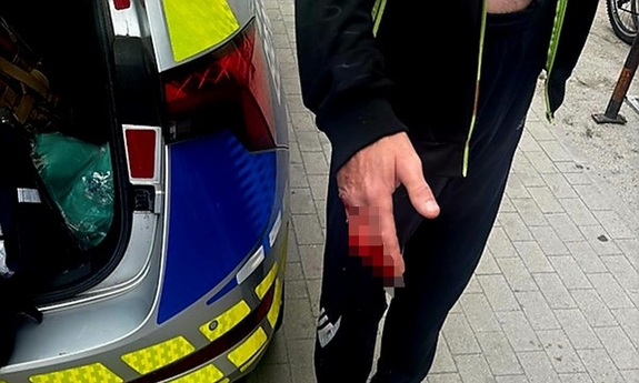 Policjanci ruszyli z pomocą krwawiącemu mężczyźnie