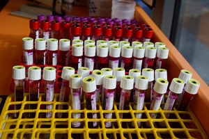 próbówki z krwią ustawione w pojemnikach